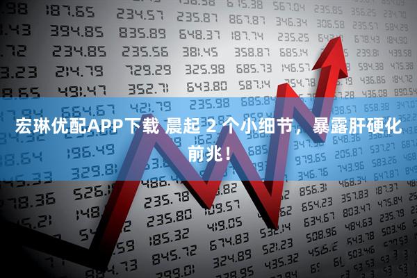 宏琳优配APP下载 晨起 2 个小细节，暴露肝硬化前兆！